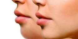 با 8 حرکت ساده غبغ را از بین ببرید + ترفندهای خنده دار ولی موثر