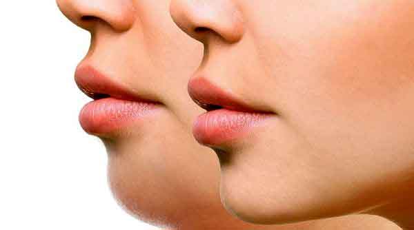 با 8 حرکت ساده غبغ را از بین ببرید