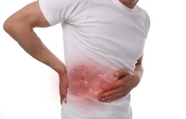 درمان درد کلیه خیراندیش و علت و علائم و راههای پیشگیری