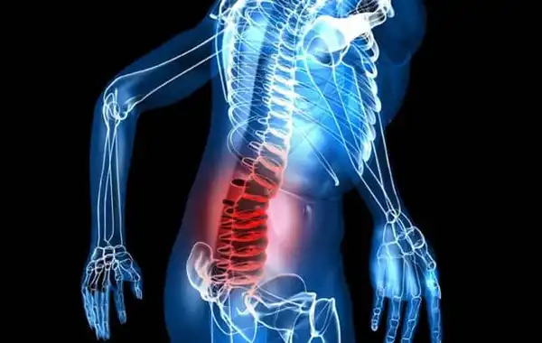 درمان التهاب دیسک کمر خیراندیش و علت و علائم و راههای پیشگیری