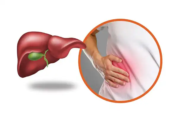 درمان پاکسازی کبد خیراندیش و علت و علائم و راههای پیشگیری