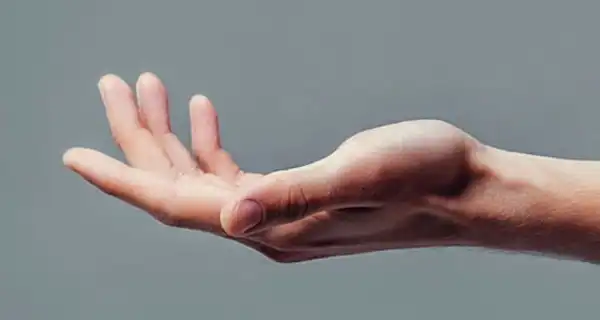 تعبیر خواب ورم+ برای دختر مجرد و زن متاهل از نظر روانشناسی