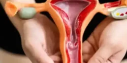 تعبیر خواب واژن + برای دختر مجرد و زن متاهل از نظر روانشناسی